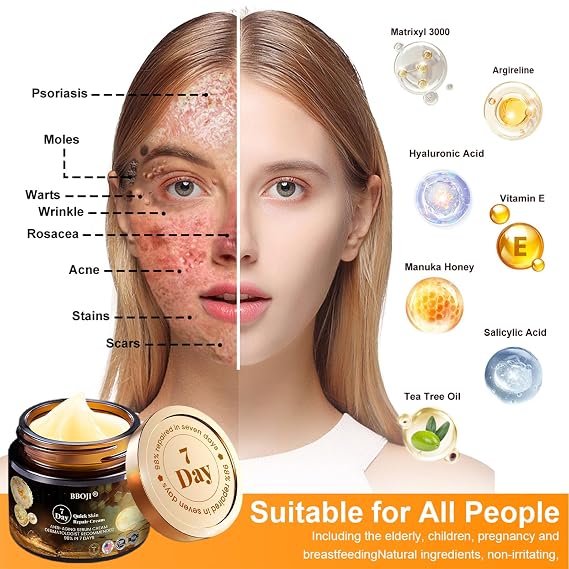 BBOJI 7-Day Multi-Effect All-in-One Skincare Cream, 2025 New Professional Bee Venom Cream, BOJI Bee Venom Skin Treatment Cream, Repair, moisturize and lift 3 in 1, for All Skin Types (1 Bottle)
