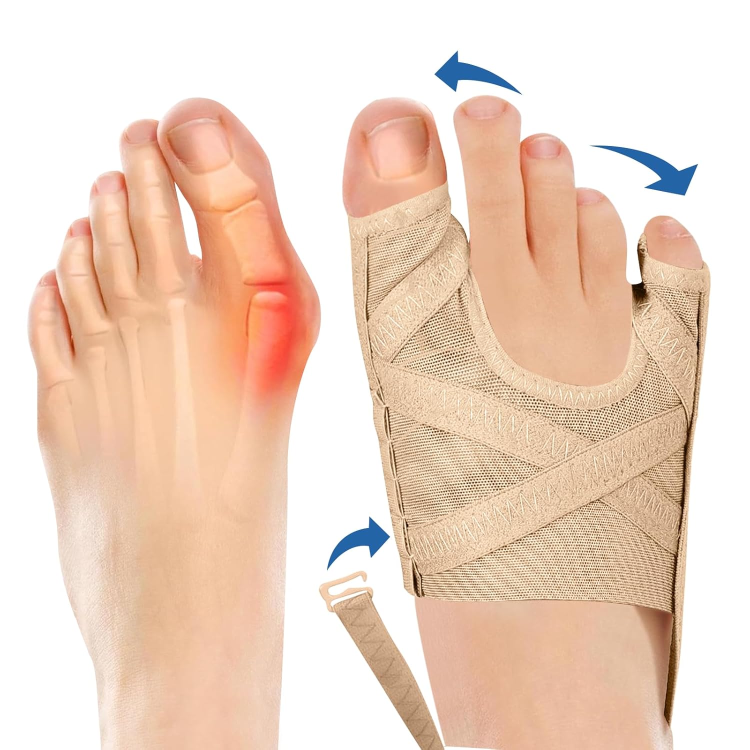 Plantarelief Bunion Corrector for Women Men Big Toe & Tail Toe Bunion