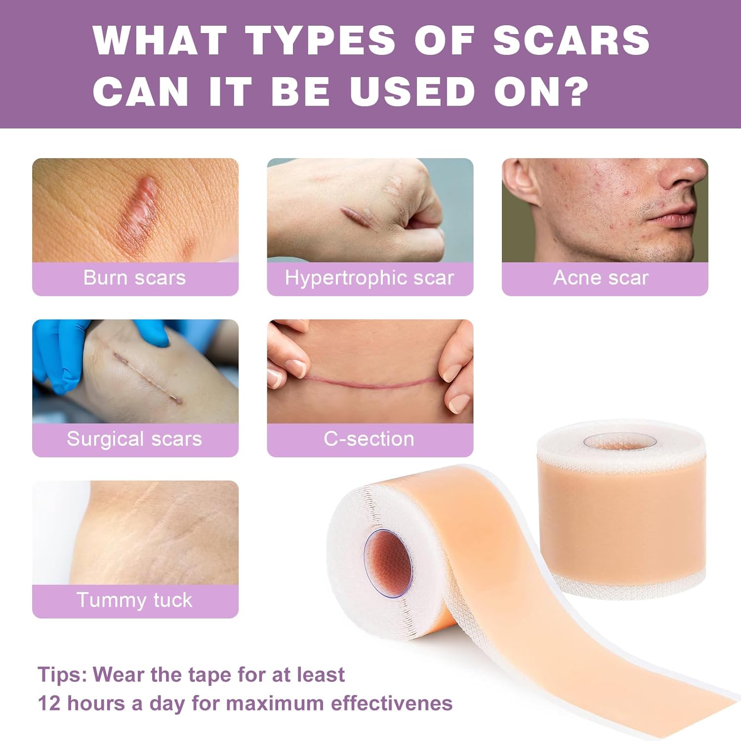 Silicone Scar Sheets 2 Rolls, Silicone Scar Tape (1.6” x 120” Roll-3M) Pro-Grade Silicone Scar Removal Strips, Reusable, Scar Tape for Wrinkles, Tummy Tuck, C-Section, Keloid, Burn, Acne Scars - Image 2