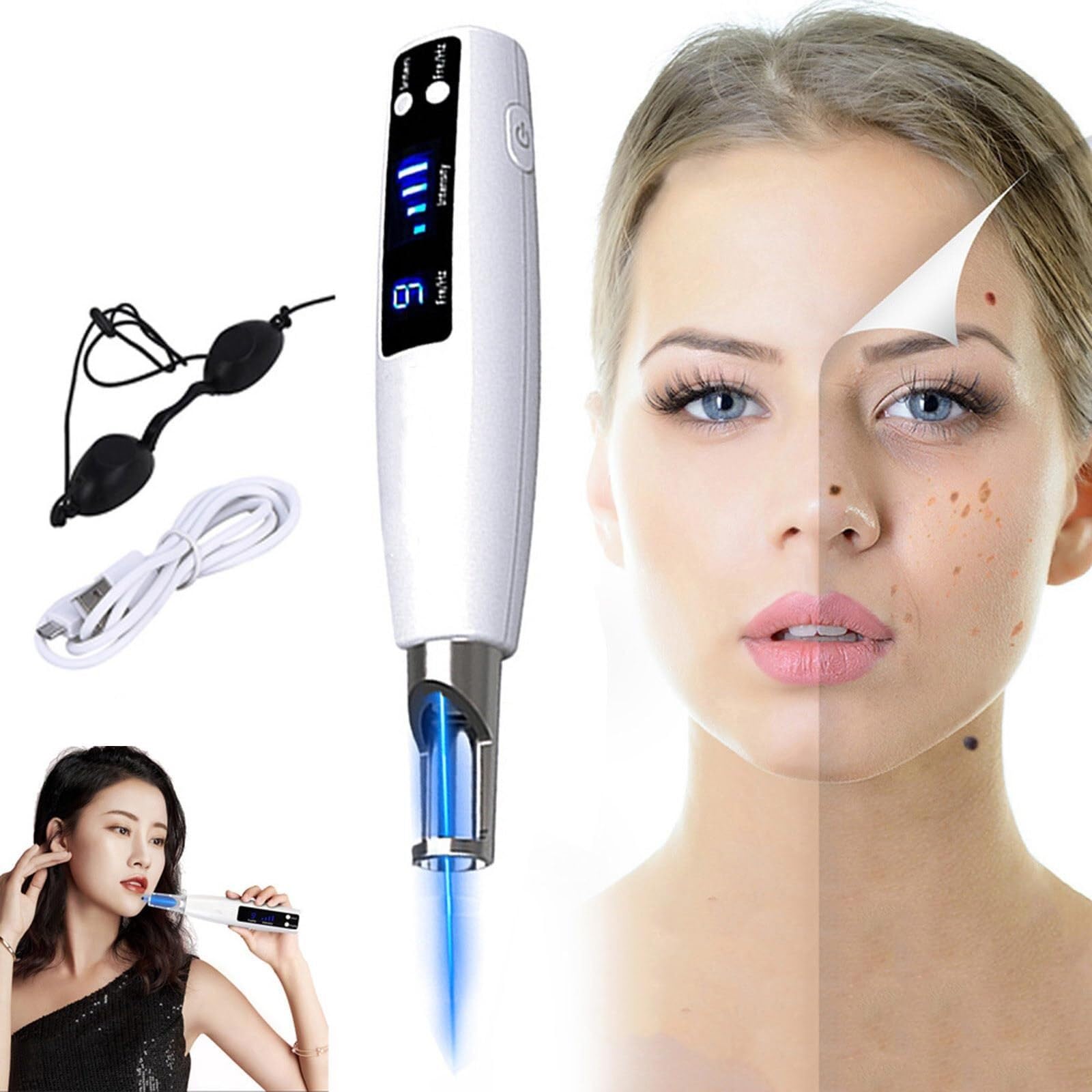 Stylo plasma picoseconde pour retrouver une peau nette à la maison
