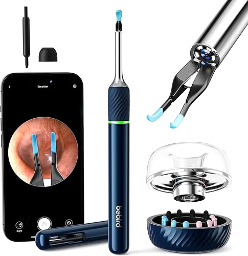 Herramienta de eliminación de cera de oídos con cámara de oído de 10 megapíxeles, kit de eliminación de cera de oídos Note 5 Pro con exquisita base