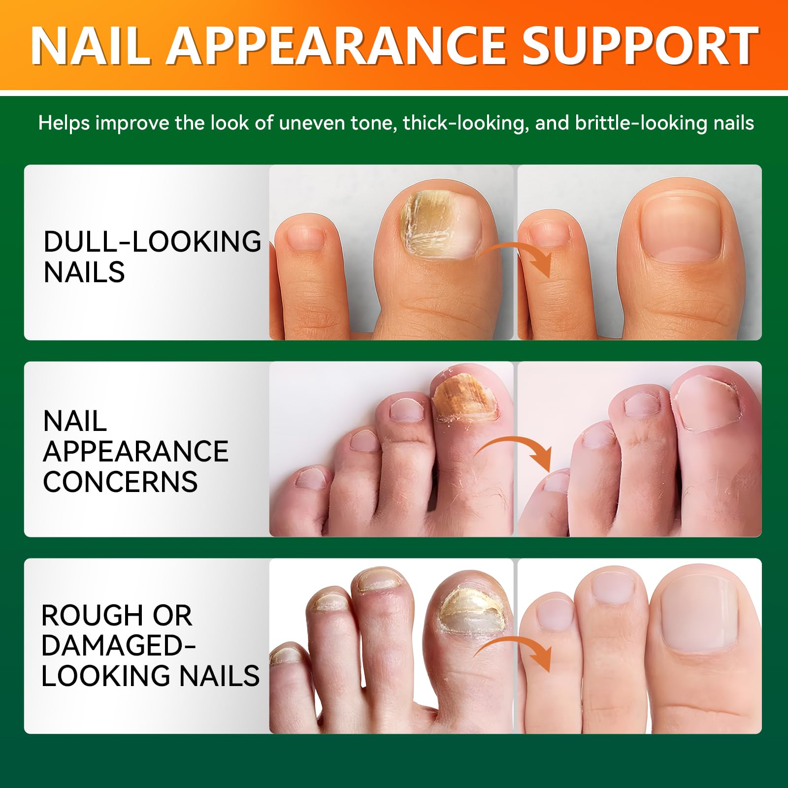 Toenail Fungus Treatment Extra Strength, Antifungal Nail Treatment with Tea Tree Oil, Menthol, Vitamin E & Pro-Vitamin B5, Gentle Nail Repair Solution to Restore Damaged, Discolored, and Brittle Nails, 1 fl oz - 5