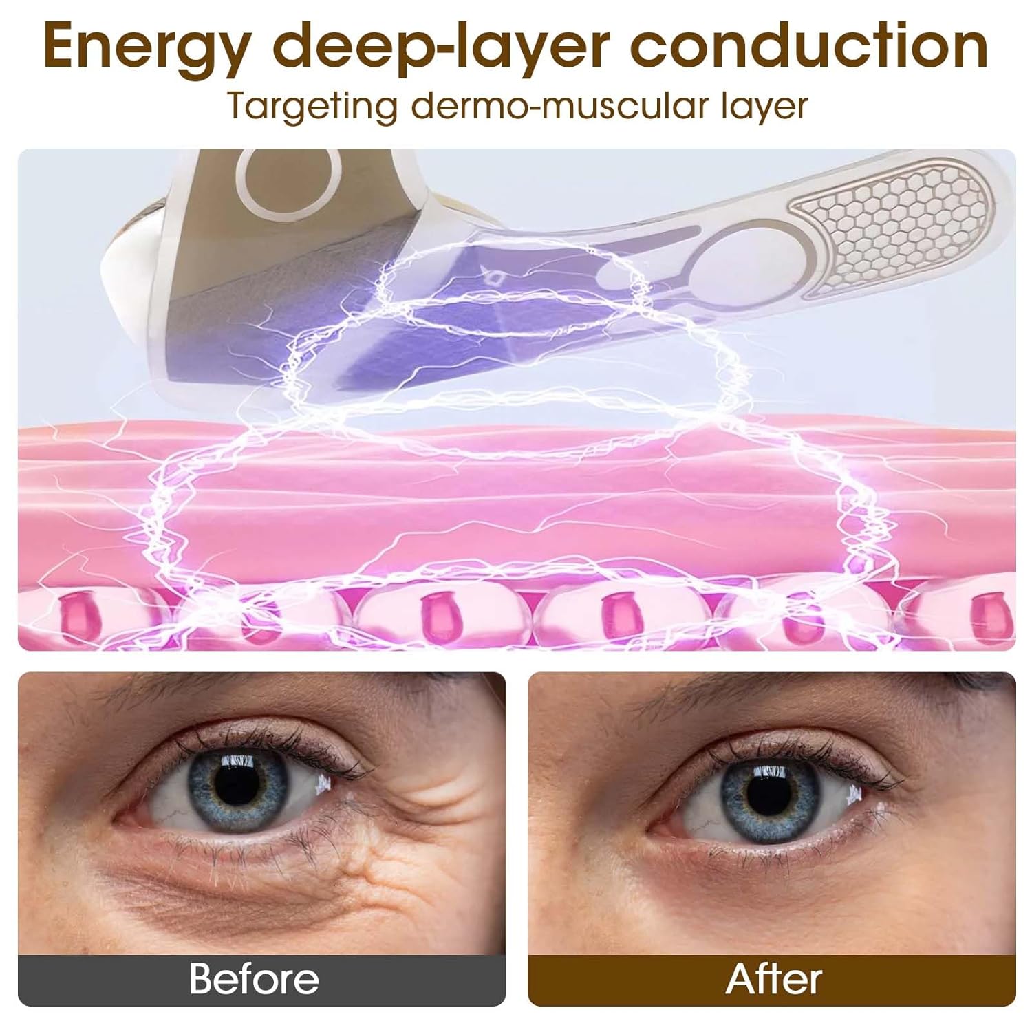 Eye Anti-wrinkle and wrinkle removal Device, Eye Patches with Hydrocolloids Collagen gel, for Dark Circles, Wrinkles & Puffiness & Smile lines