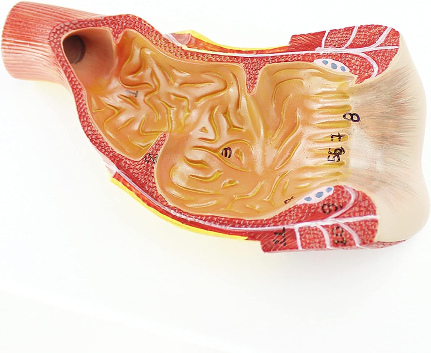 Modèle Anatomique du Rectum et de l'anus Humains, Anatomie Humaine Scientifique, Outils et Aides à la Formation des chirurgiens généraux en Chirurgie anorectale