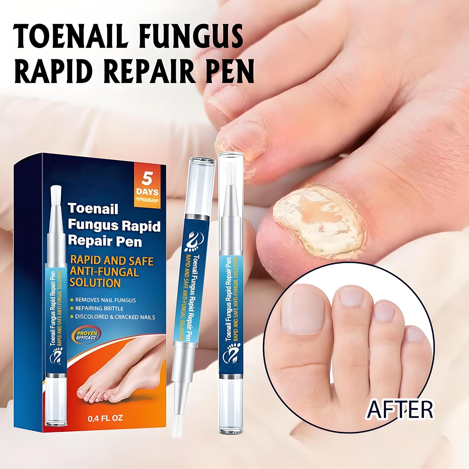 4PCS Fungal Nail Pen for Toenails and Fingernails Extra Strong Nail Care Fungus with Deep Penetration Formula - Image 2
