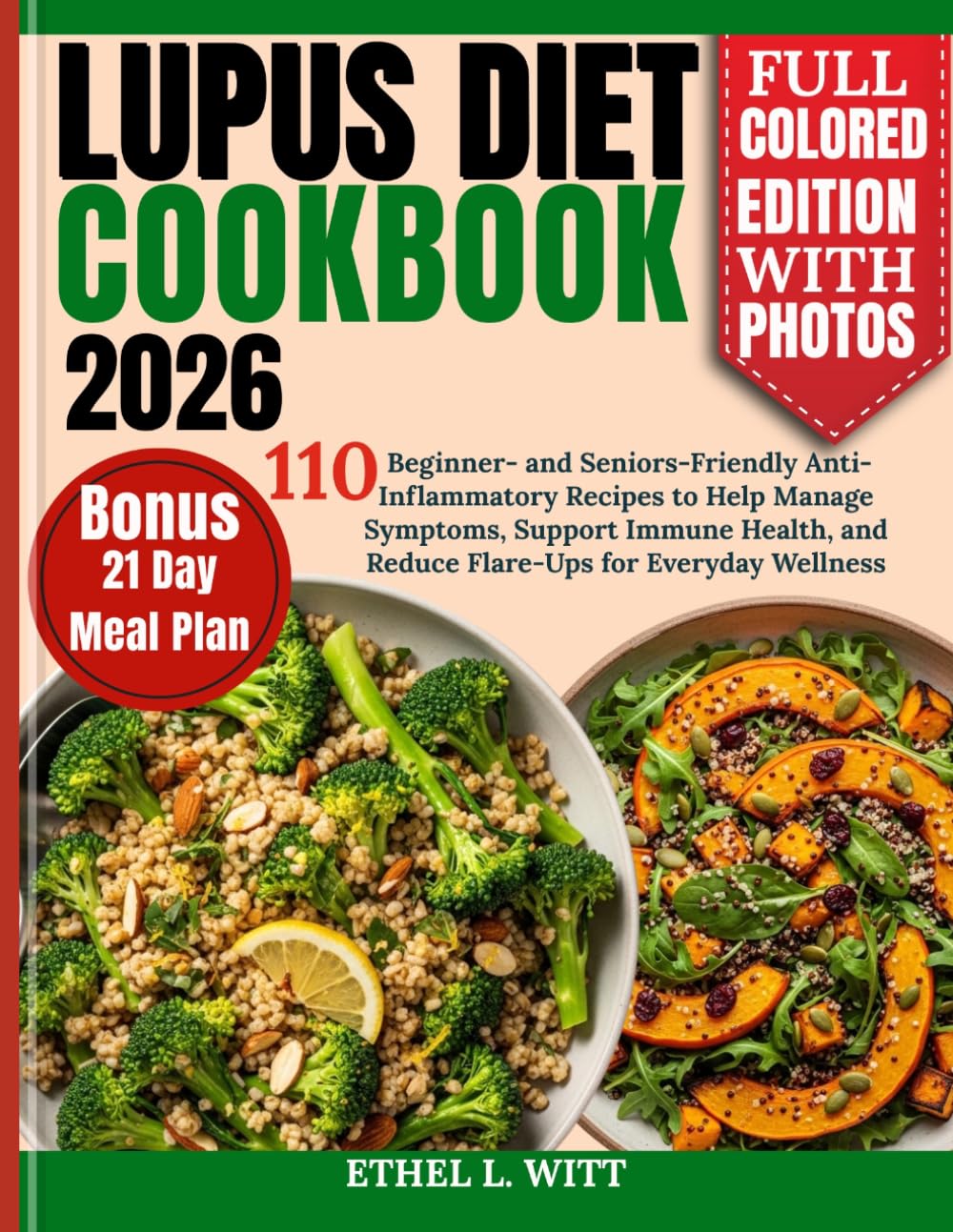 Lupus Diet Cookbook 2026: 110 Beginner- and Seniors-Friendly Anti-Inflammatory Recipes to Help Manage Symptoms, Support Immune Health, and Reduce Flare-Ups for Everyday Wellness