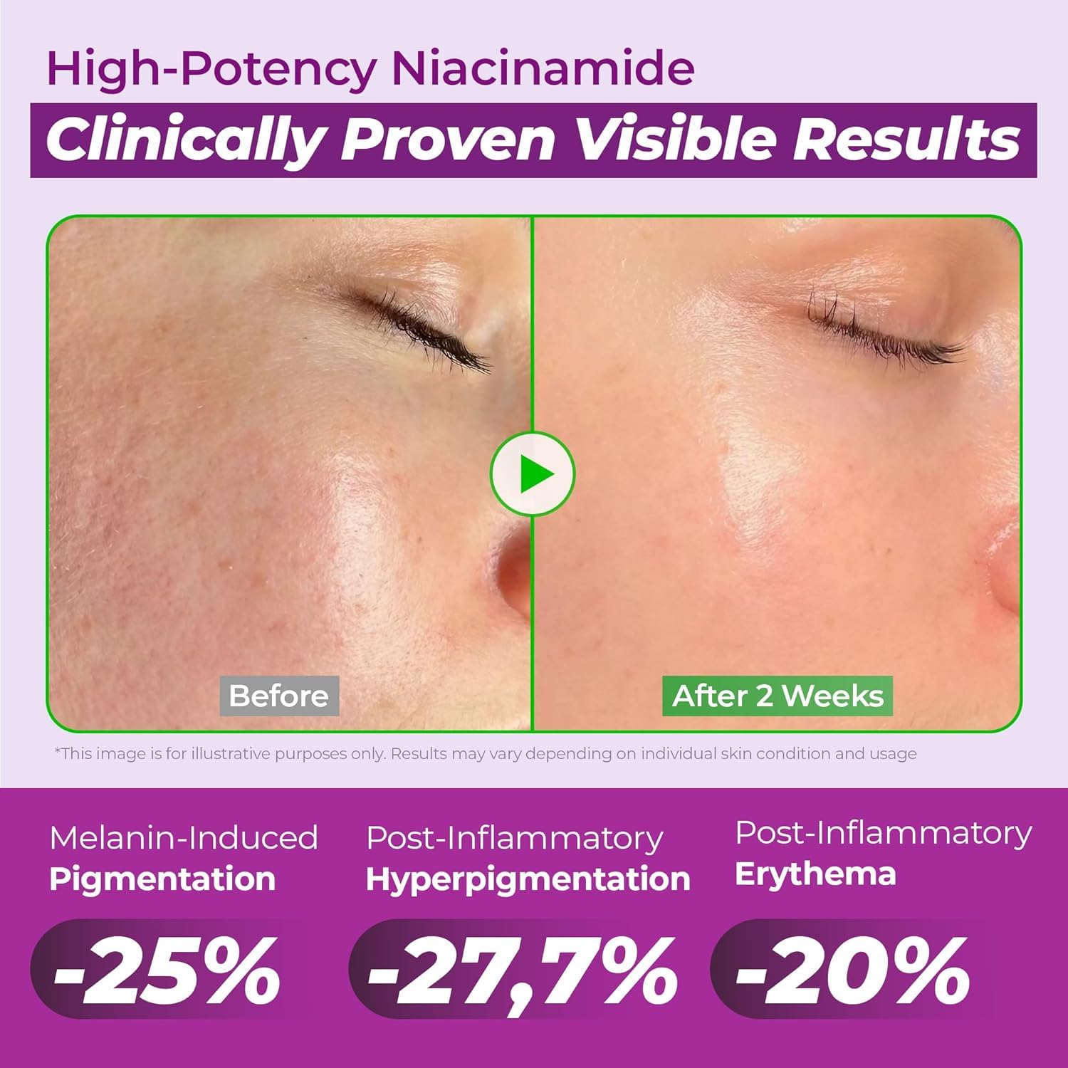 Jumiso Niacinamide 20 Serum 40ml