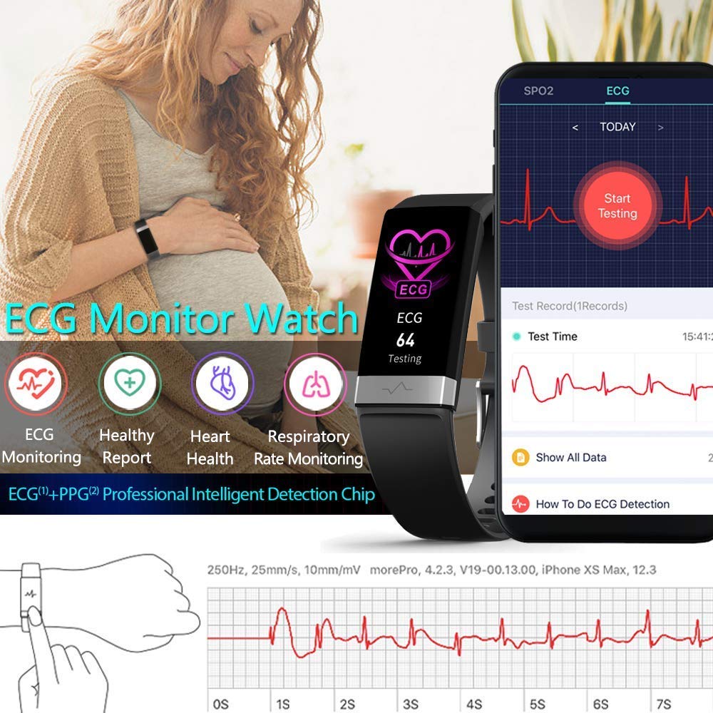 Smartwatch