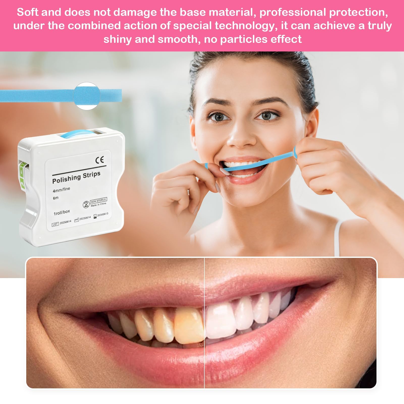 Papel de lija interdental 6 m arena fina rollo resina pulido dental
