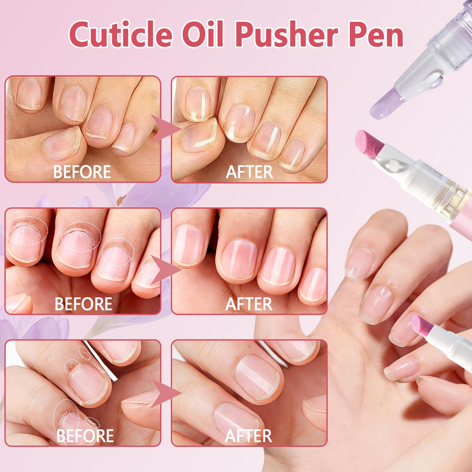 2PCS Penna Spingi Cuticole 2 in 1, Penna 3 in 1 con olio per cuticole, Olio Cuticole Unghie, 3-In-1Nail Care Pen, Nutriente E Lucidante,Cura Delicata,Adatto Per Unghie Secche E Danneggiate