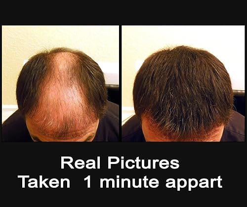 Miniatura 2 de Samson - Recambio de fibra capilar de 3.53 onzas, para ocultar la pérdida de cabello, Estados Unidos, adecuado para todas las marcas (marrón oscuro)