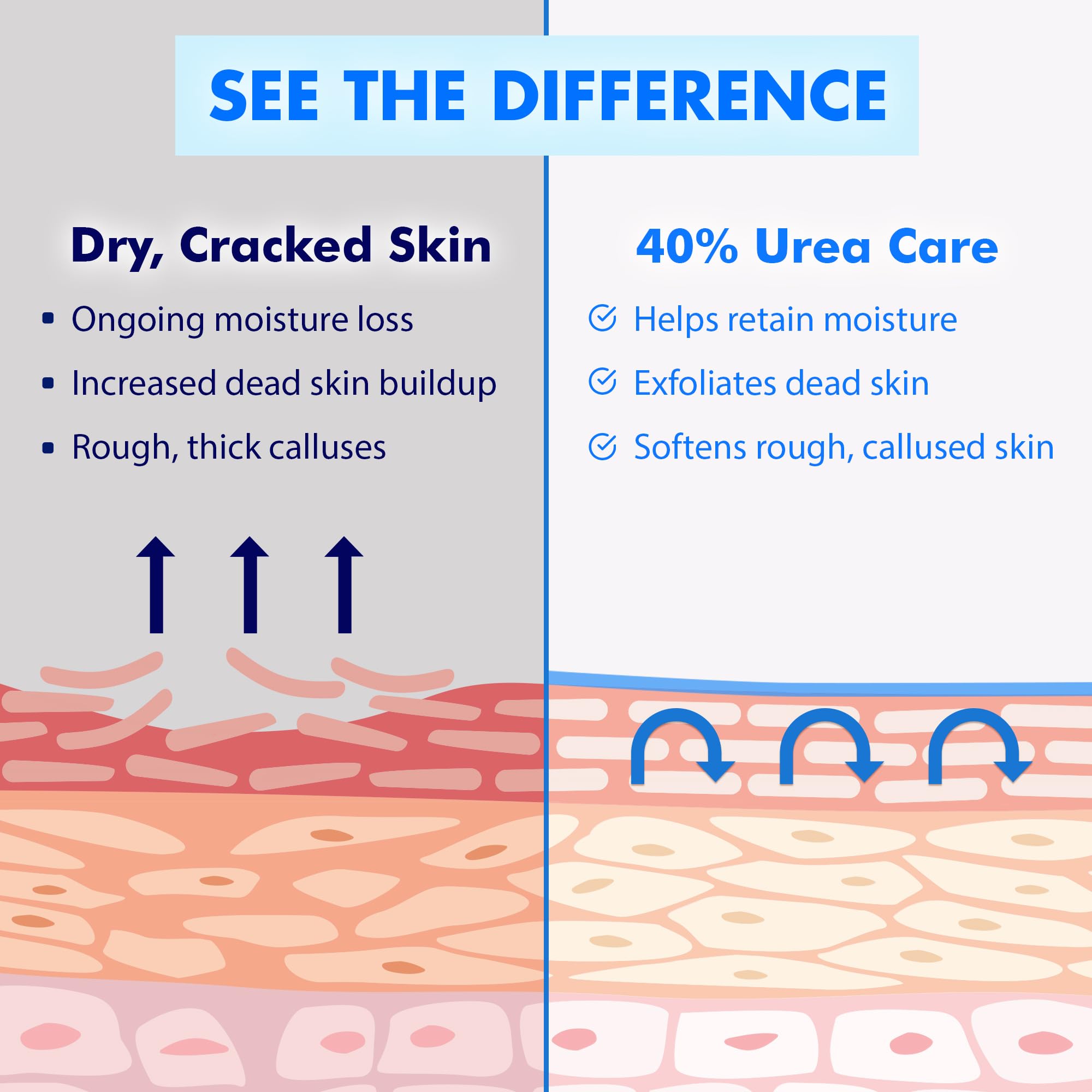 Ebanel Urea Cream - Heal Dry Cracked Feet -6