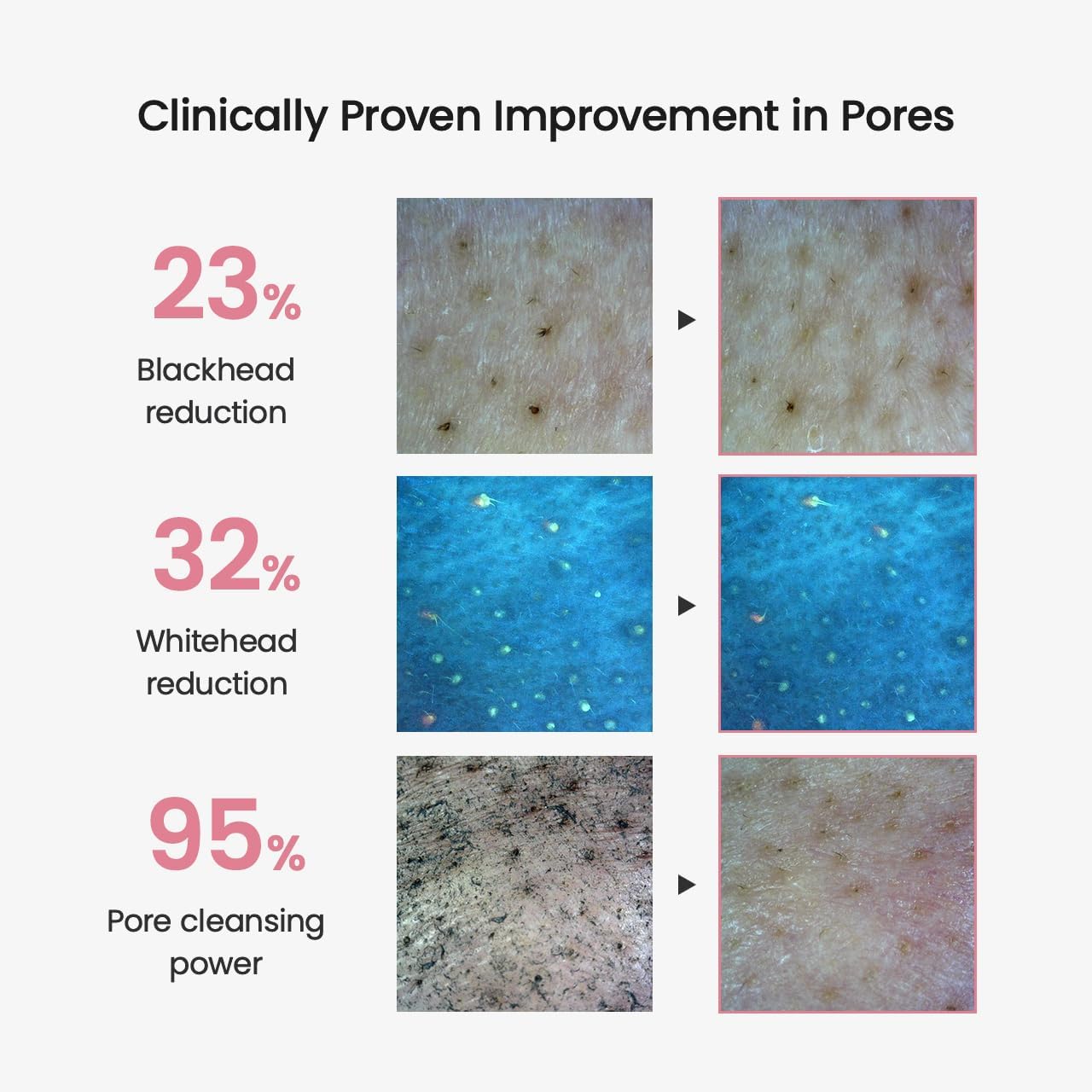 BIODANCE Collagen Cleansing Oil, Facial Oil Cleanser, Gentle Makeup Remover, Removes Bleackhed and Whitehead for Sensitive Skin, Korean Skin Care, Valentines Day Gifts for Herㅣ6.76 fl. oz. (200 ml) - Image 7