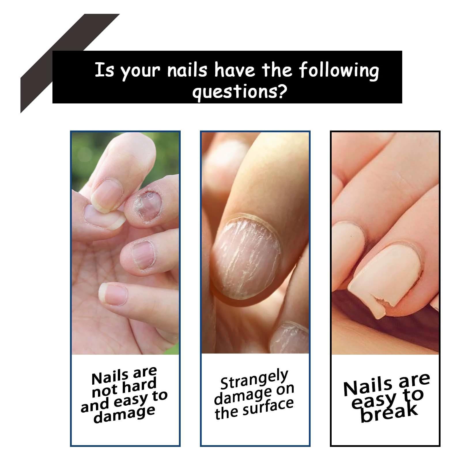 Nail Growth & Repair Serum, Strengthener & Hardener for Damaged Nails. Promotes Healthy Growth, Restores Strength - Image 2