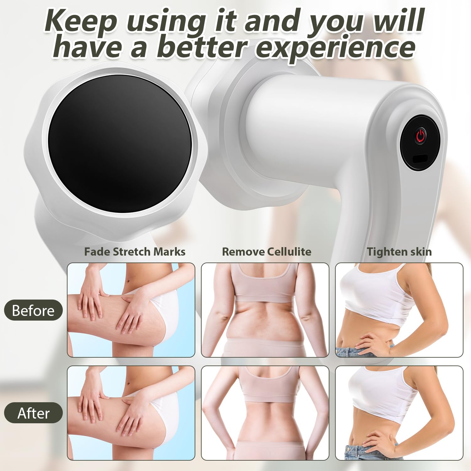 Masseur Anti Cellulite Electrique, Appareil de Massage Cellulite Rechargeable avec 6 Têtes Massage 8 Vitesses pour Remodelage et Perte de Poids Corps Jambes Ventre Bras Fessiers