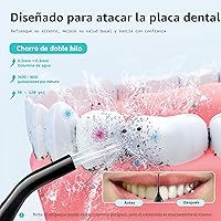 Vista 2 de COSLUS Hilo Dental de Agua: Irrigador Oral Portátil Inalámbrico 300ML Recargable Limpiador de Viaje IPX7 Impermeable Máquina de Hilo Dental