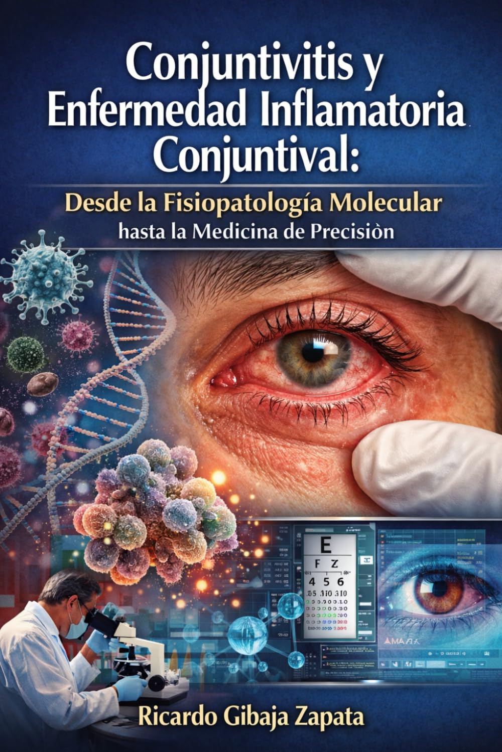 Conjuntivitis y Enfermedad Inflamatoria Conjuntival Desde la Fisiopatología Molecular hasta la Medicina de Precisión