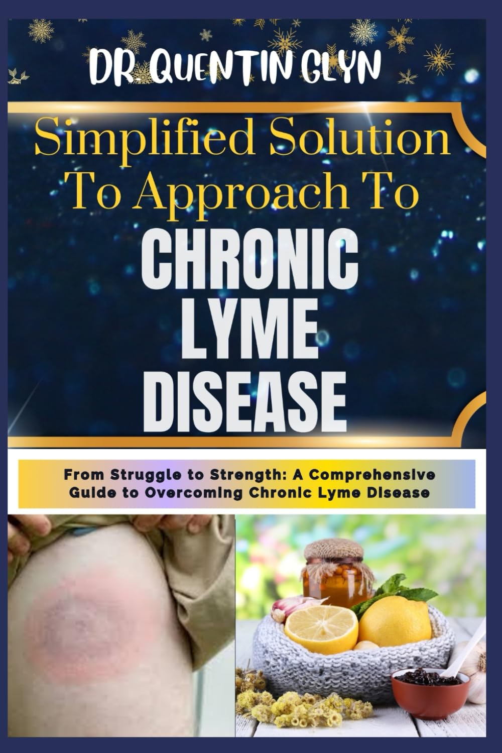 Simplified Solution Approach To CHRONIC LYME DISEASE: From Struggle to Strength: A Comprehensive Guide to Overcoming Chronic Lyme Disease