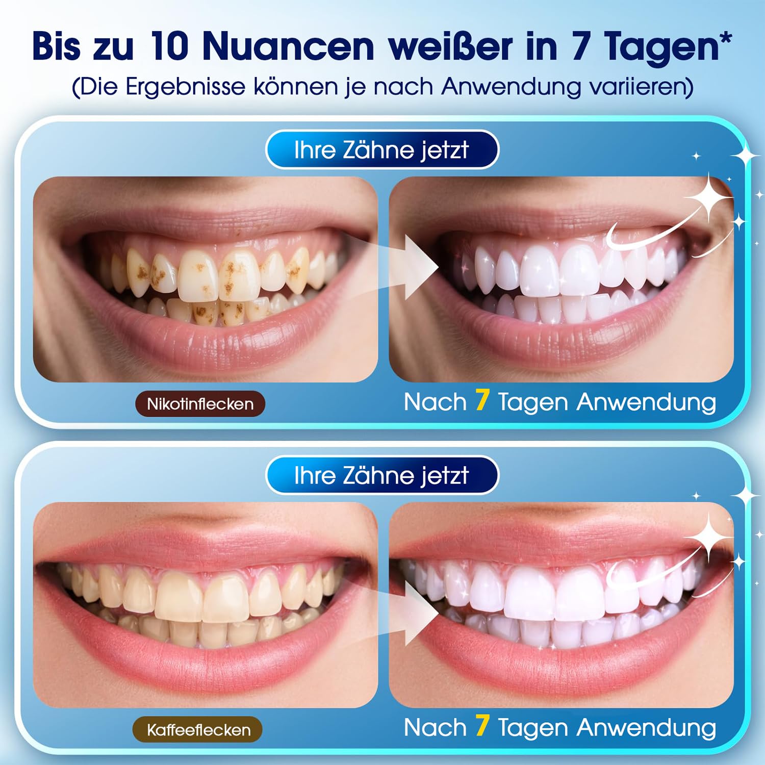 Zahnaufhellungsset mit LED-Licht – 3 Whitening-Gel-Stifte + 2 Desensibilisierungs-Gel-Stifte – 35% PAP-Aufhellungsformel – Zahnbleaching für zu Hause – Sichtbar weißere Zähne in 7 Tagen (Minze)