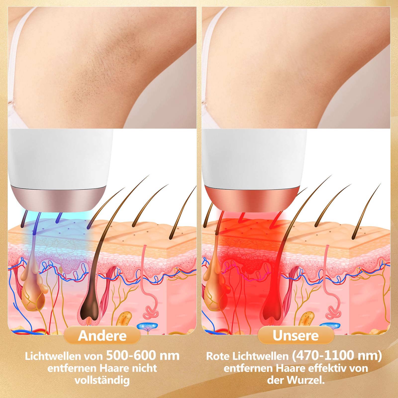 IPL Depilazione - Depilazione indolore e permanente con luce pulsata intensa (IPL) per viso e corpo, ideale per uso domestico, bianco