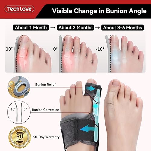Miniatura 2 de Tech Love Corrector de juanetes para mujeres y hombres, 1 par, férula ajustable para juanetes con 2 barras angulares, almohadillas para alivio de