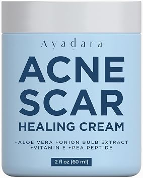 AYADARA Acne Scar Cream, 2 fl oz, Moisturizing Face & Body Cream for Face, Stretch, Acne Marks, Hydrating Formula for All Skin Types, 200+ Uses