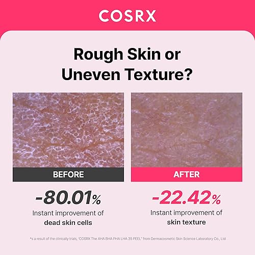 Miniatura 2 de COSRX AHA BHA PHA LHA 35% Peel 1.01 fl. oz / 1.0 fl oz, gel exfoliante químico para piel opaca, áspera y grasa con células de piel obstruidas de