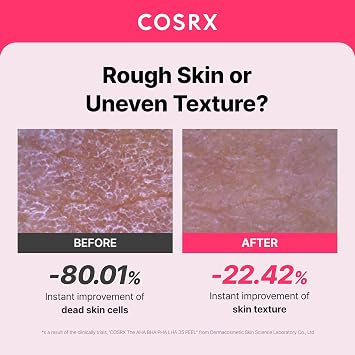 COSRX AHA BHA PHA LHA 35% Peel 1.01 fl. oz / 30 ml, Chemical Exfoliating Peeling Gel for Dull, Rough, Oily skin with Clogged Pored & Dead Skin Cells, Highly Concentrated