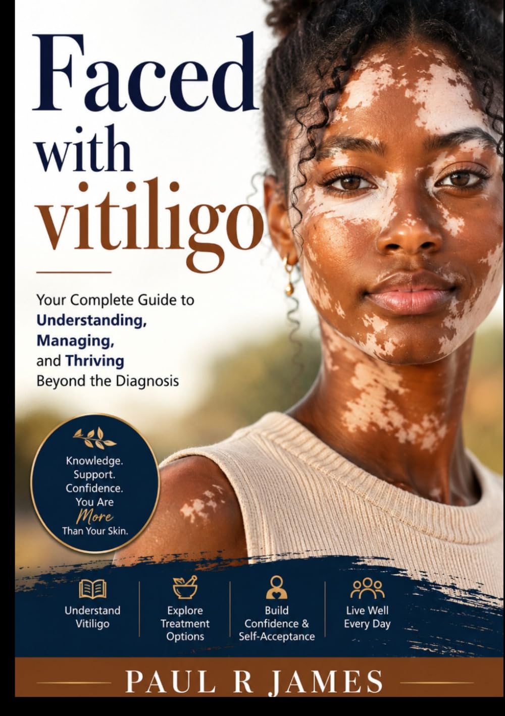 Faced with vitiligo: Your Complete Guide to Understanding, Managing, and Thriving Beyond the Diagnosis