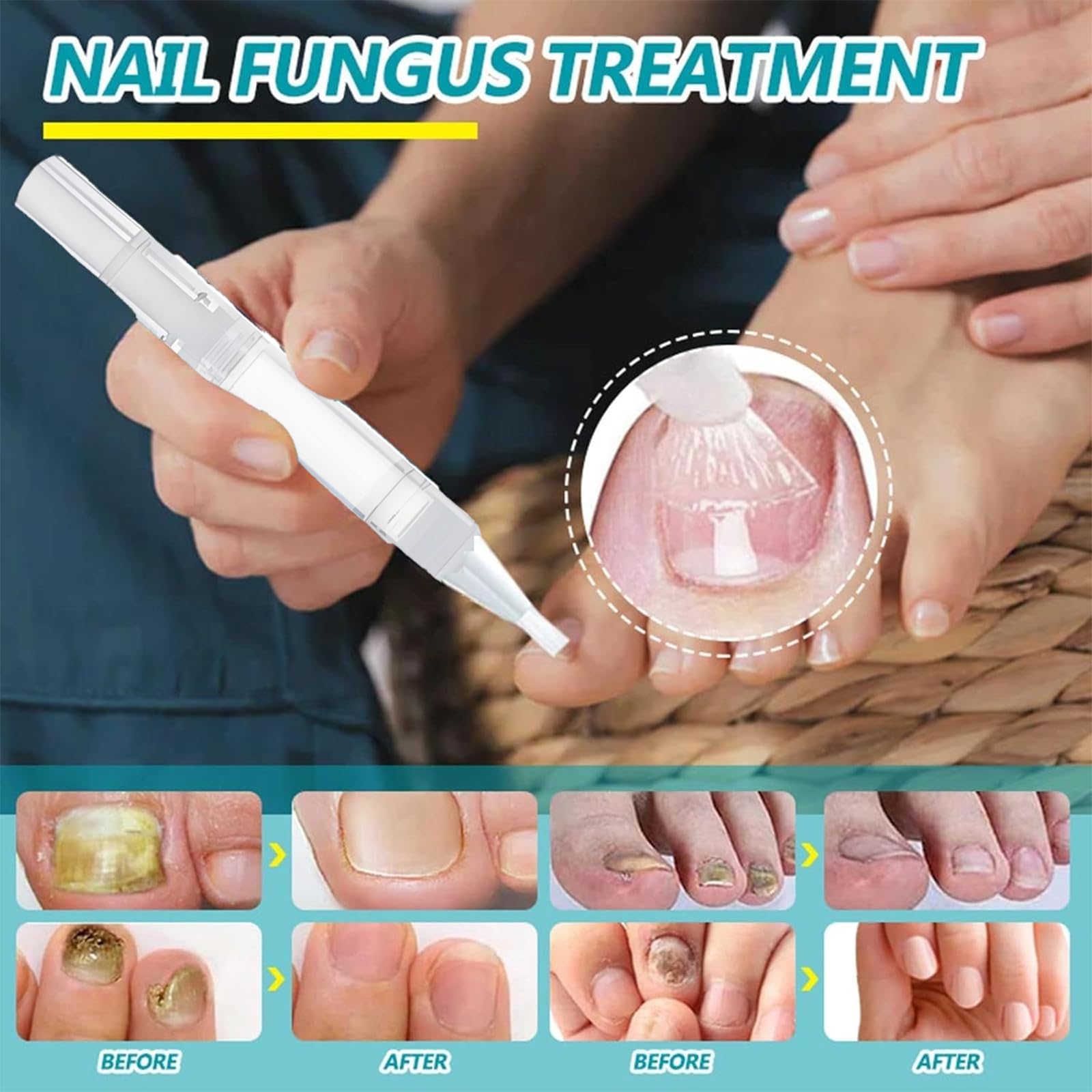 Penna per la cura delle unghie, illumina la superficie del rimuovi cuticole, olio 3 in 1 per unghie secche e danneggiate, amplificatore idratante per unghie sospese, portatile (14 pezzi)