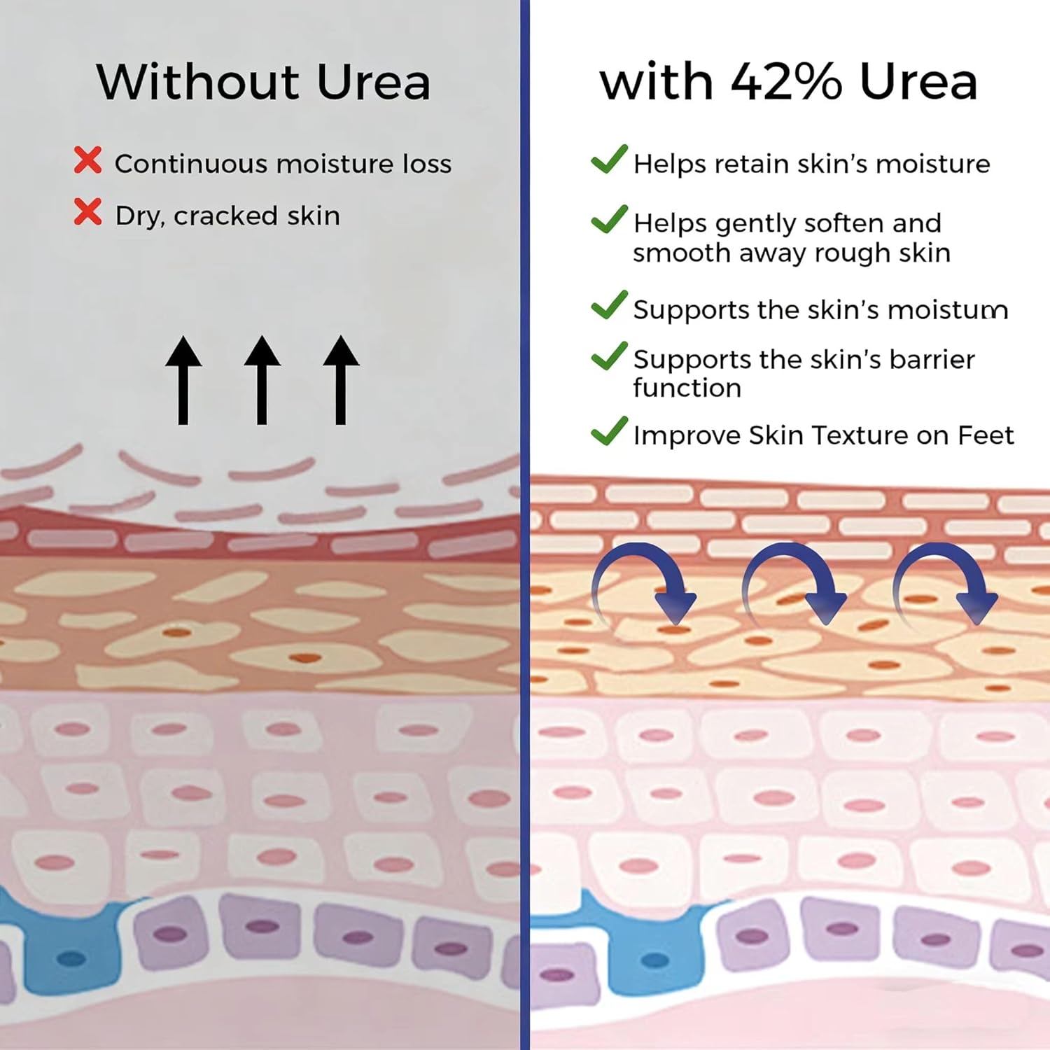 OUKEYA Urea Cream with Salicylic Acid for Dry, Rough Skin – Moisturiser for Feet, Heels, Hands & Elbows, 5.29 Oz - Image 5