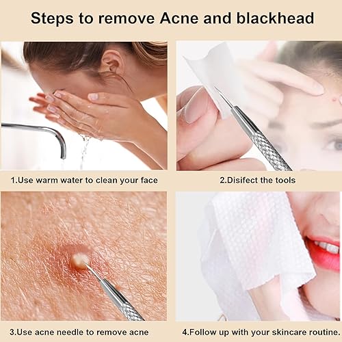 Miniatura 5 de Paquete de 2 herramientas de eliminación de espinillas 2 en 1, herramientas profesionales para eliminar puntos negros, herramienta de acné y comedia