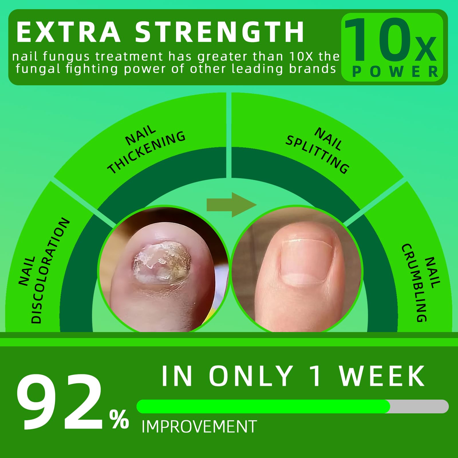Toenail Fungus Treatment Extra Strength, Brush-On Nail Fungus Treatment with Botanical Oils for Thick, Yellow, Brittle, Discolored & Damaged Toenails 1 Fl Oz (Pack of 1) | — Amazon image 5