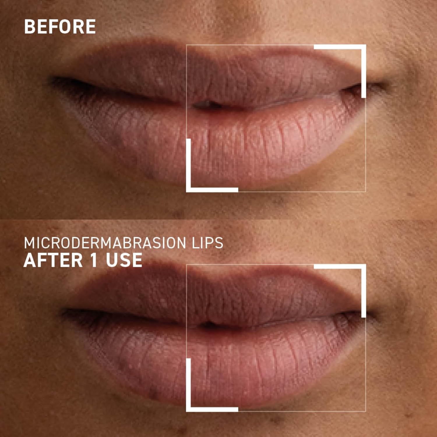 Dr. Brandt Microdermabrasion Smoothing Lip Exfoliator - Polishes & Conditions Dry, Flaky Lips to Renew Skin + Prepare for Color Application - 0.35 oz