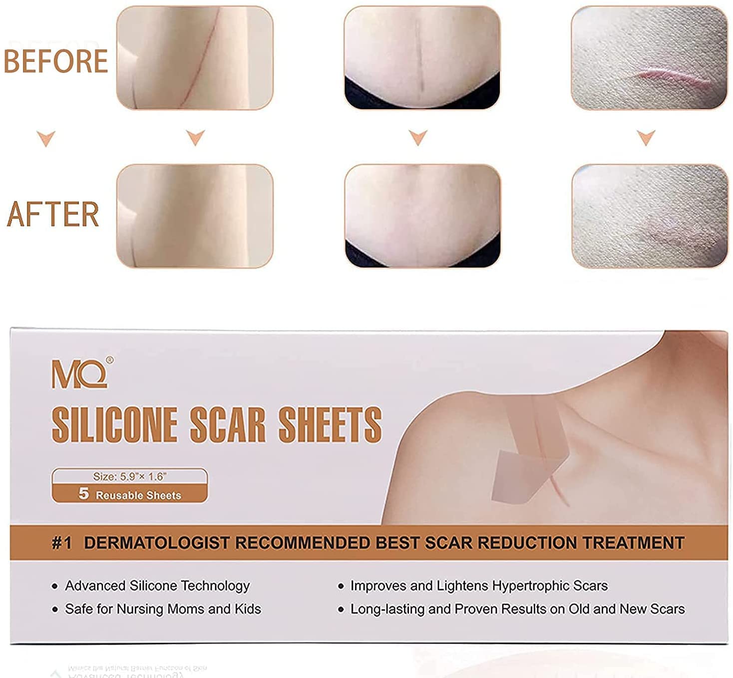 20PCS Silicone Scar