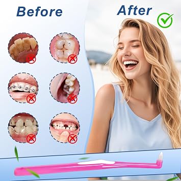 6 Pcs Compact Interspace Toothbrush, Single Tufted Interspace Brush, Slim Teeth Brush, Designed for Effective Dental Cleaning, Helps Clean Hard-to-Reach Areas with Deep Cleaning Action