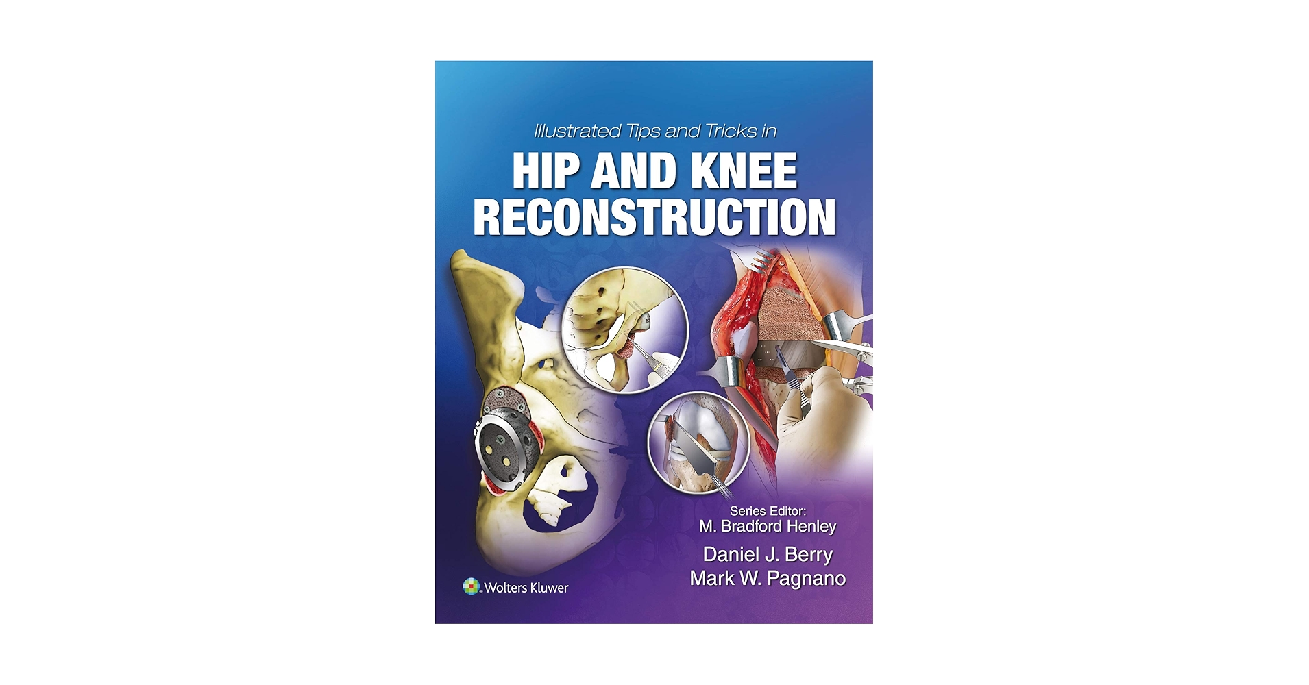 健康・医学 Harborview Illustrated Tips and Tricks i Harborview Illustrated Tips and Tricks in Fracture