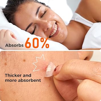 TKTK Bulk Acne Patches Day and Night 435 Count + Pimple Patches for Face 443 Count, 5 Sizes Pimple Stickers for Covering Zits, Blemishes and Breakouts