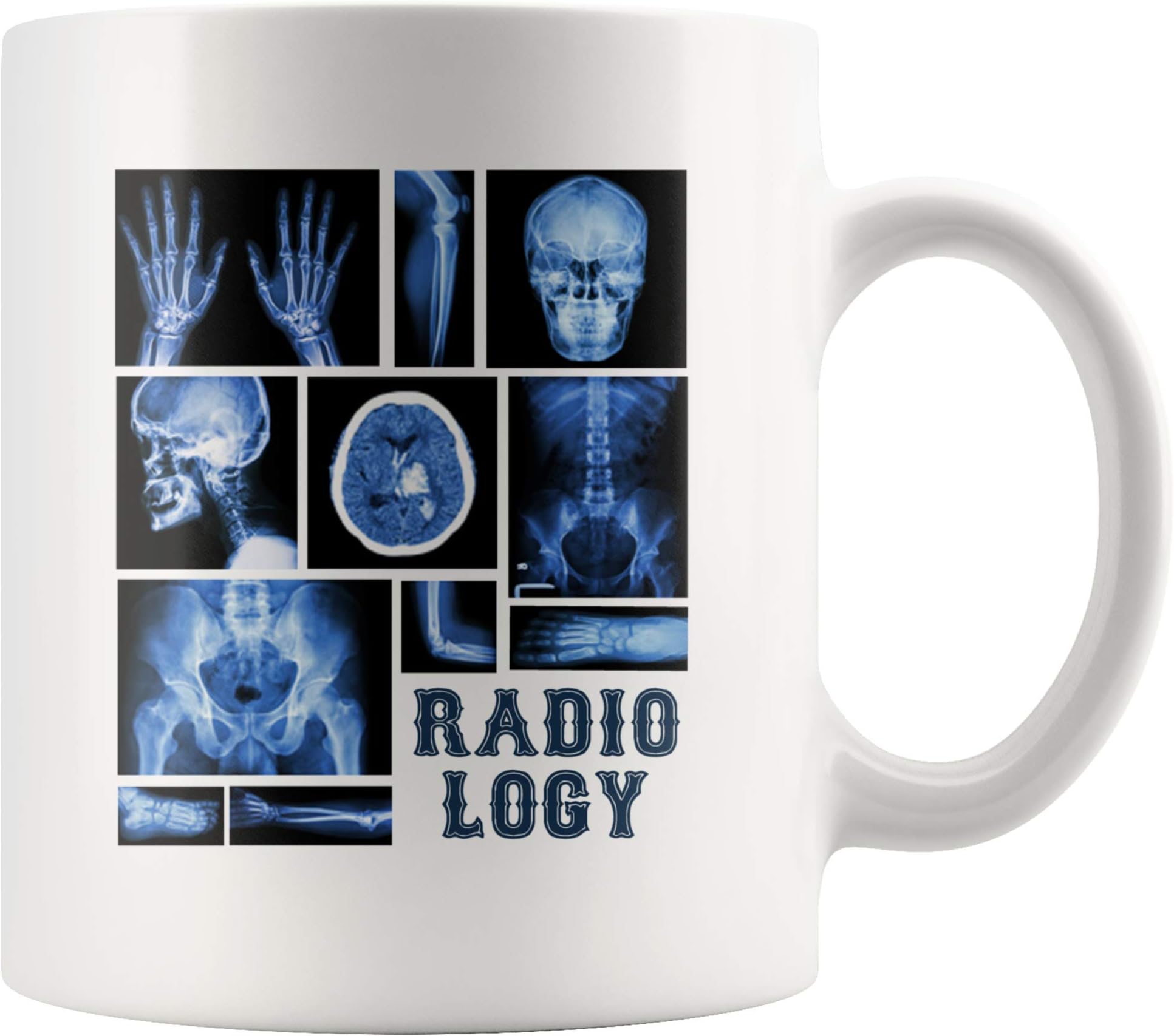 LAMX Funny Radiology X-Ray Tech Radiologist Science Themed Mug Human Skeletal System Anatomy for Students Teachers Novelty Drinkware Ceramic Coffee Tea Cup 11 oz White