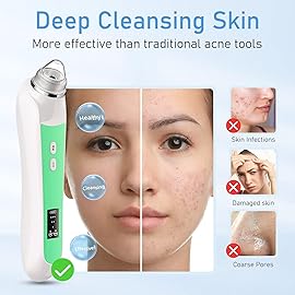 Facial Pore Blackhead Remover Vacuum, 1080P Camera Blackhead Remover, 20x Zoom, 8 LEDs  3 Suction Modes, 800mAh Battery & USB - 6 Heads Pore Cleaner Kit for Women&Men(Green)