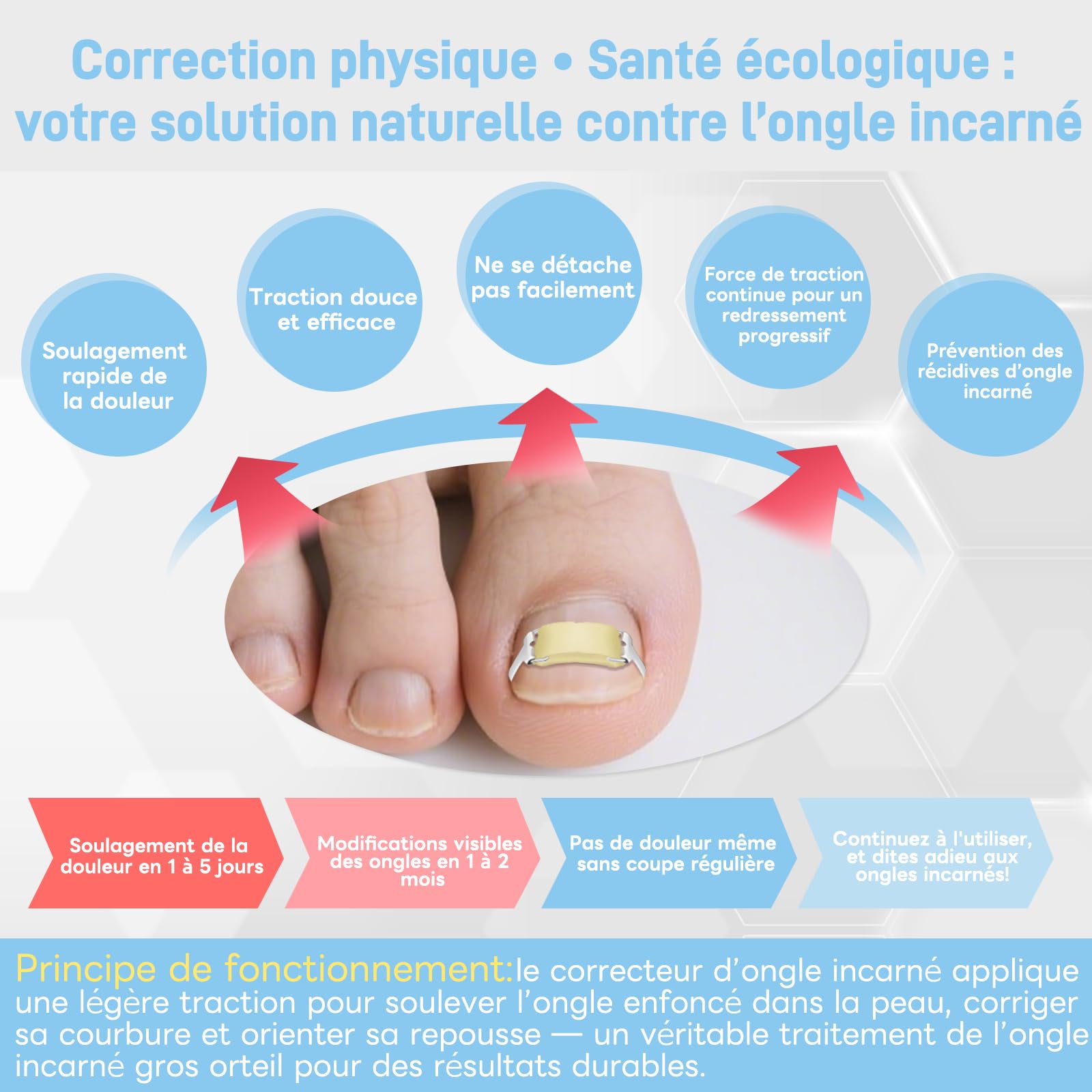 InhwRior Correcteur d’ongle incarné,facile à utiliser à la maison, stable et sûr, sans glissement, traction continue pour un soulagement rapide de la douleur, étanche pour la douche(19mm-21mm)
