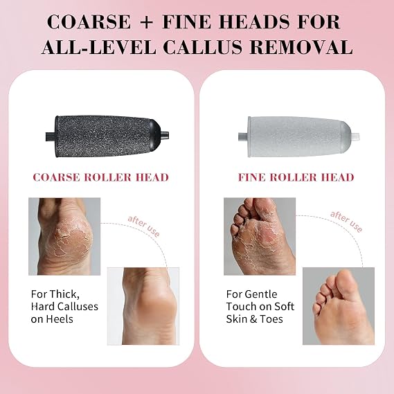 Foot Callus Remover, Electric Callus Remover for Feet with Dual Roller Heads, 2 Speeds & LED Light, 3 Faster Than Manual, 90-Min Runtime, Pedicure Tools for Feet, Foot File for Home Use