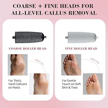 Foot Callus Remover, Electric Callus Remover for Feet with Dual Roller Heads, 2 Speeds & LED Light, 3 Faster Than Manual, 90-Min Runtime, Pedicure Tools for Feet, Foot File for Home Use