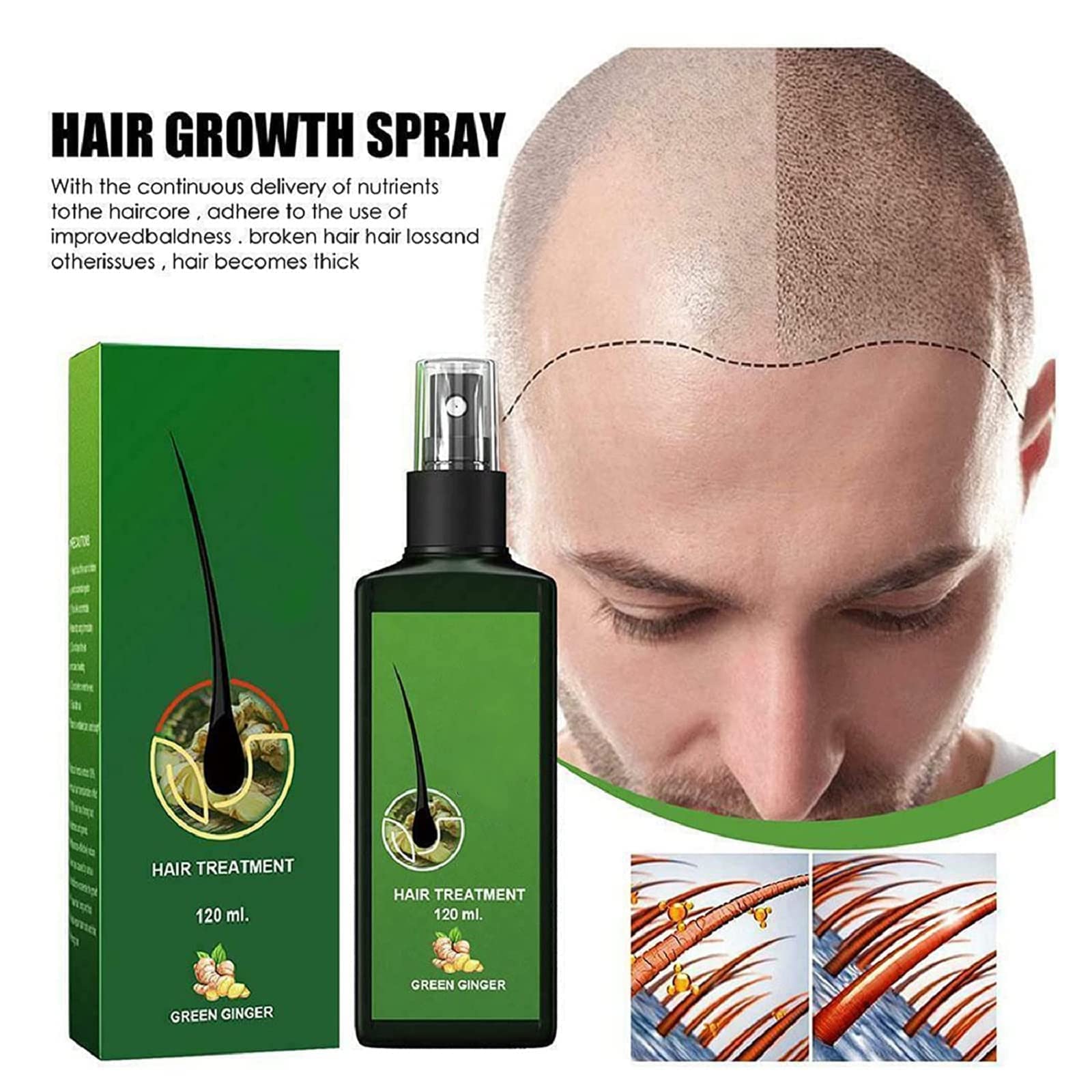 Loción capilar para el crecimiento del cabello, 3 unidades para hombres y mujeres, mejora N3, Growthplus Nourishing Ginger Spray, Hair Lotion Hair Root Hair Beard with Roller, Hair Lotion Herbs