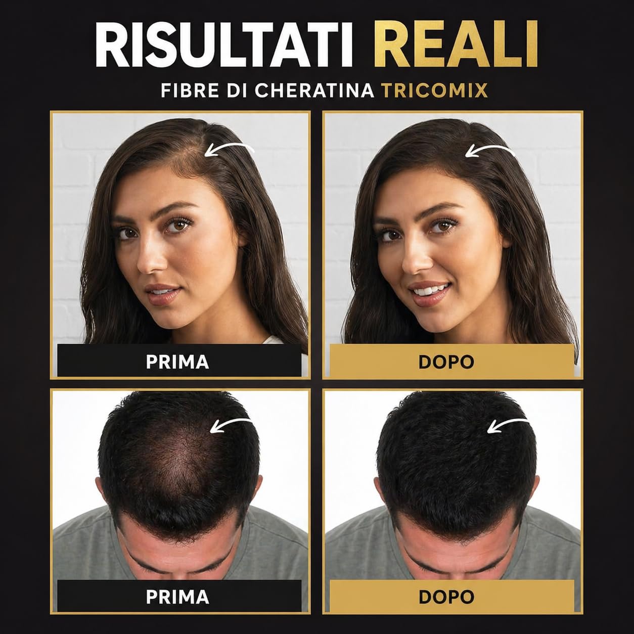 Hair Applicator per Fibre di Cheratina – Applicatore Spray di Precisione per Fibre Capelli, Distribuzione Uniforme e Naturale, Compatibile con Flaconi TRICOMIX