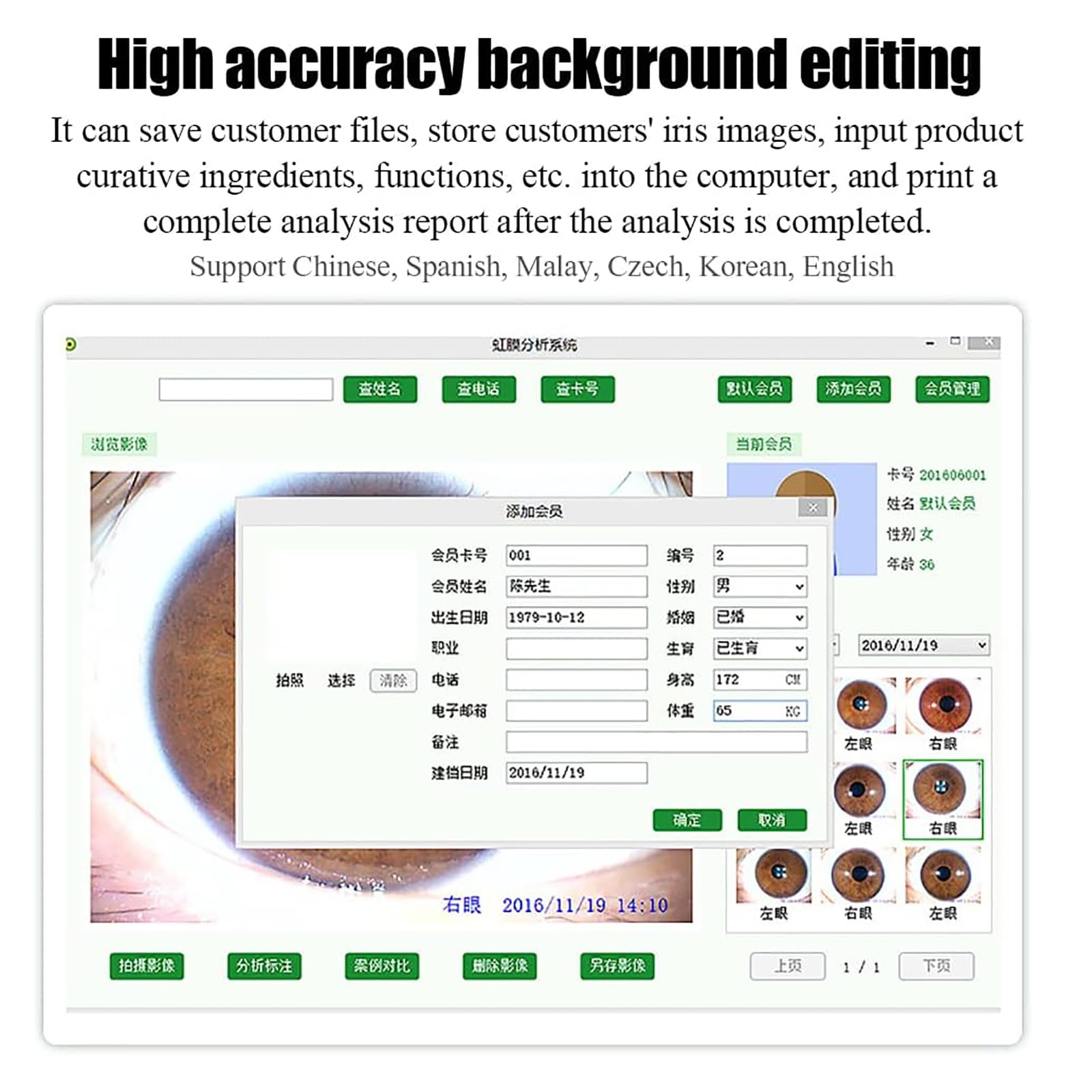 Dispositivo per L'analisi Dell'iride, Analizzatore Dell'iride con Software di Analisi Intelligente Associato E Obiettivo 30X da 5 Milioni di Pixel, Messa a Fuoco Regolabile E Scientifico