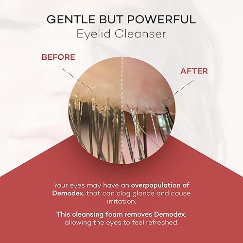 Miniatura 4 de Zocular ZocuFoam - Limpiador de párpados - Exfoliante espumoso para párpados, solución natural equilibrada de pH - 1.7 onzas líquidas (1.7 fl oz)