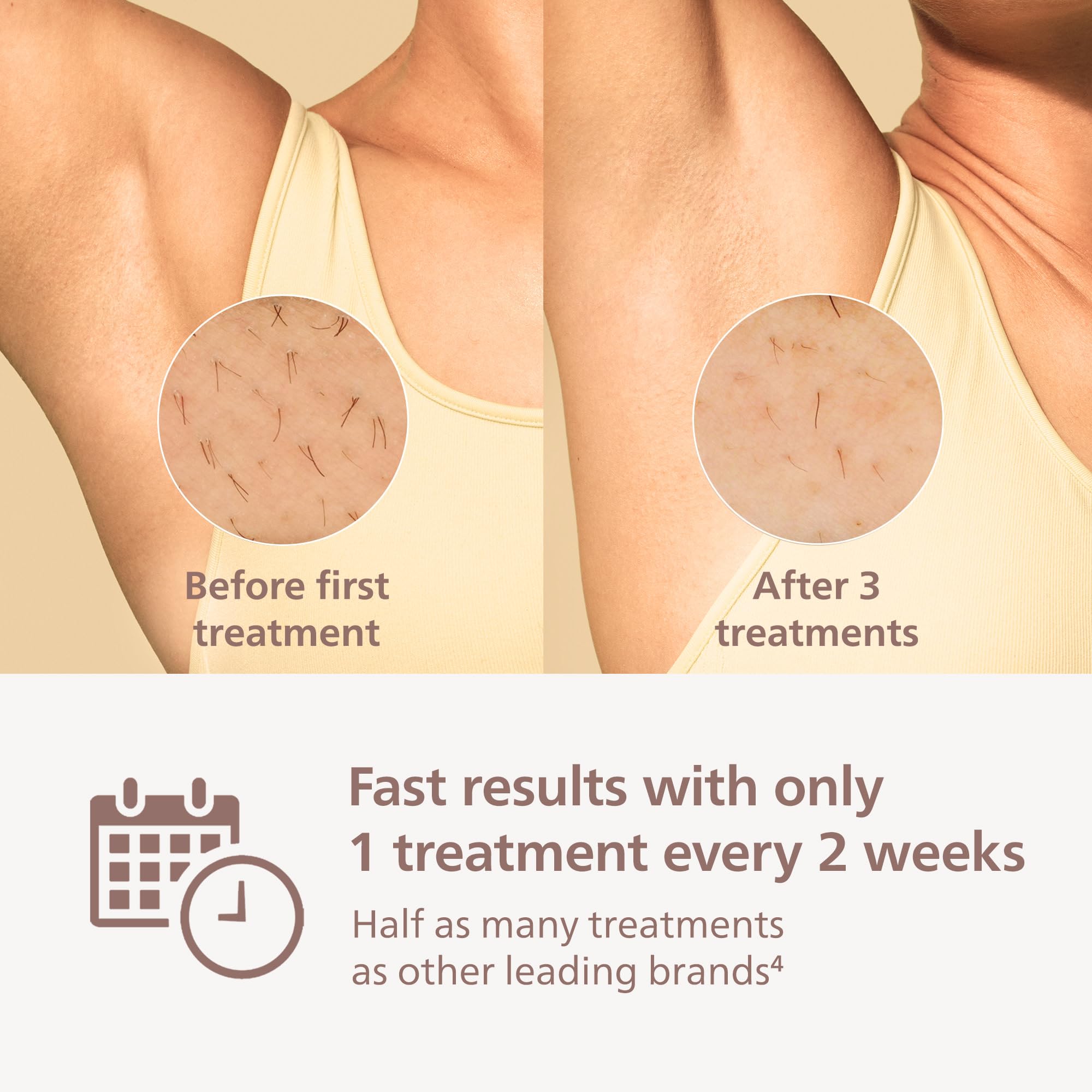 Philips Lumea 7000 Series IPL Hair Removal Device - Permanent Visible Hair Reduction Done at Home, SenseIQ Technology, Uniquely Curved Attachment for Body, for Women & Men, BRI931/03