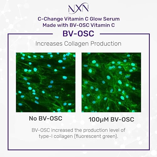 Miniatura 3 de Variación del suero, Vitamina C