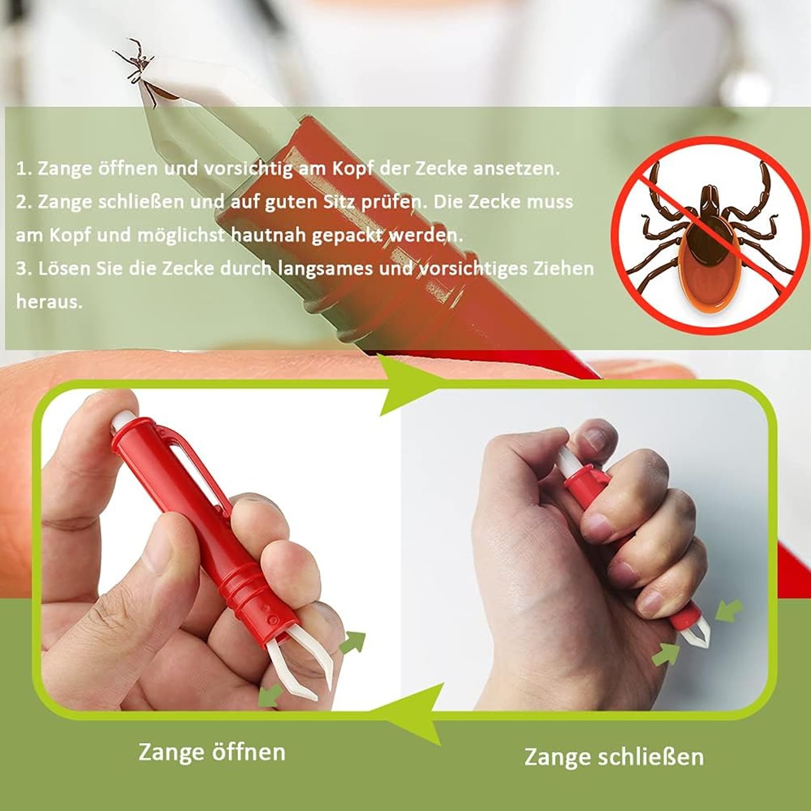 Carte De Retrait De Tiques - Tire-Tique Avec Loupe, Nettoyage Rapide Des Tiques, Parfait Pour Retirer Les Tiques, Avec Crochet Et Tire-Tiques, Pour Humains, Chiens, Chats Et Animaux Domestiques